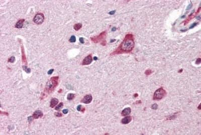 Immunohistochemistry-Paraffin: QSOX2 Antibody [NBP3-14459]